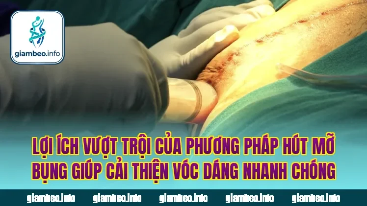 Lợi ích vượt trội của phương pháp hút mỡ bụng giúp cải thiện vóc dáng nhanh chóng