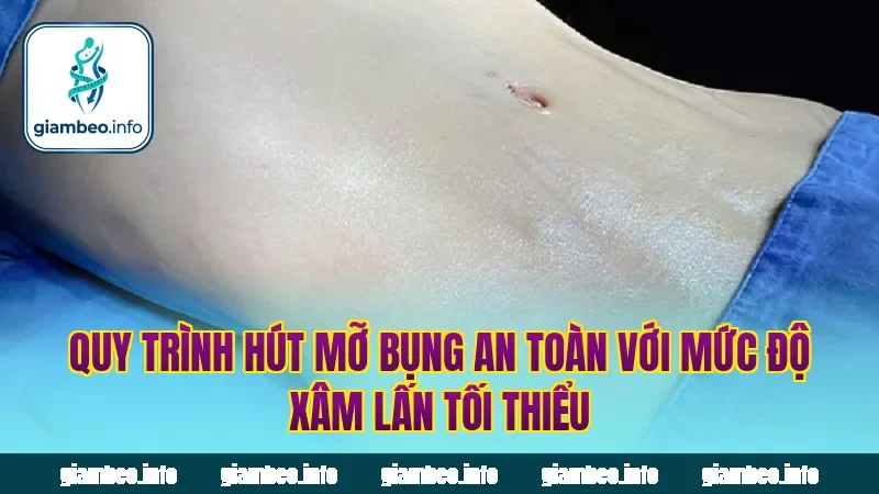 Quy trình hút mỡ bụng an toàn với mức độ xâm lấn tối thiểu